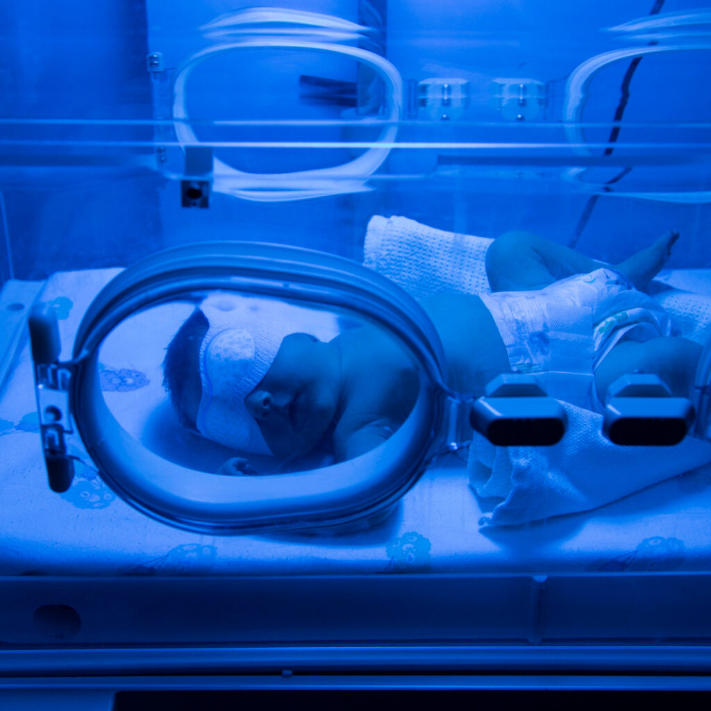 bebê recém-nascido, vestindo apenas fralda e uma máscara de proteção nos olhos, deita-se dentro de uma incubadora neonatal sob uma forte luz azul de fototerapia