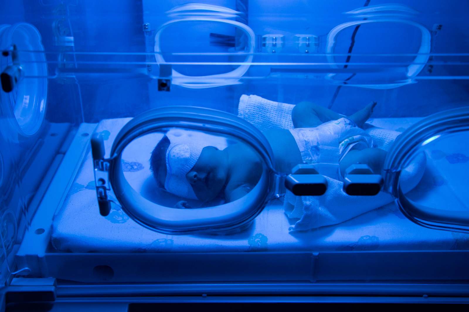bebê recém-nascido, vestindo apenas fralda e uma máscara de proteção nos olhos, deita-se dentro de uma incubadora neonatal sob uma forte luz azul de fototerapia